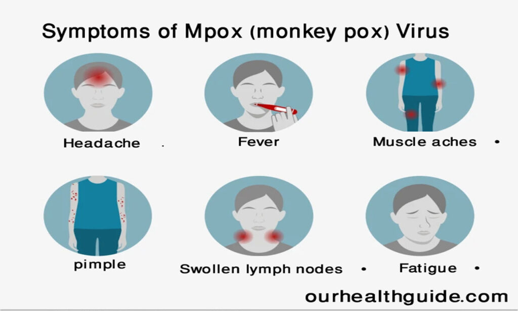 Symptoms of monkey pox