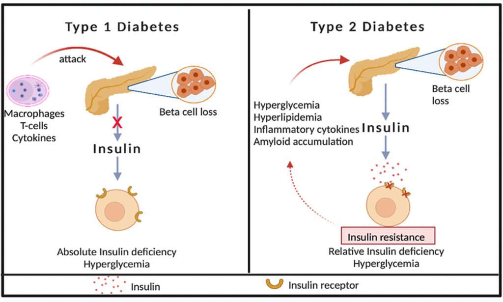 Difference between Type 1 & Type 2 Diabetes