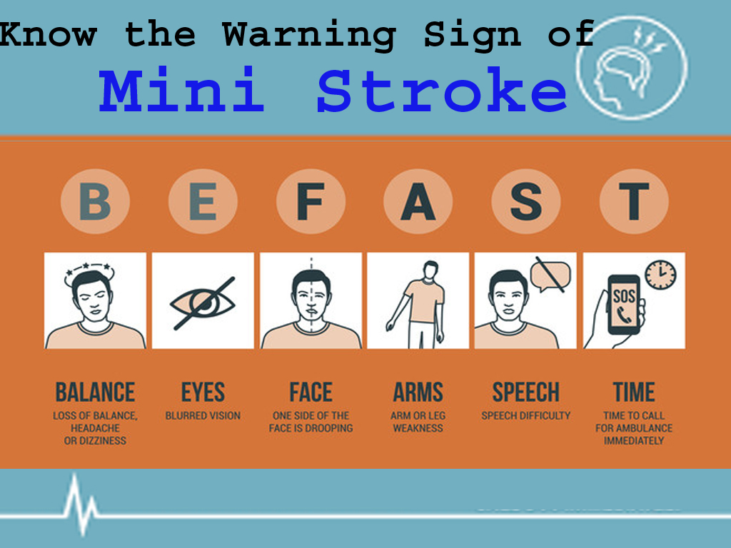 Mini Stroke