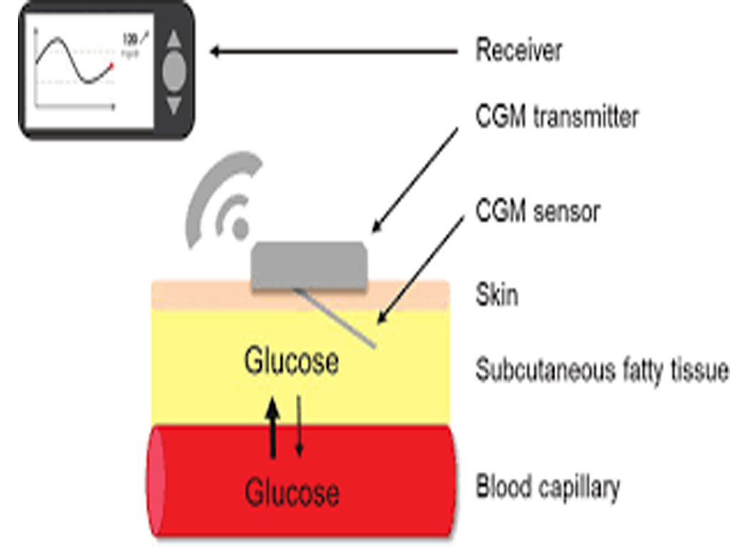 Continuous glucose monitoring devices