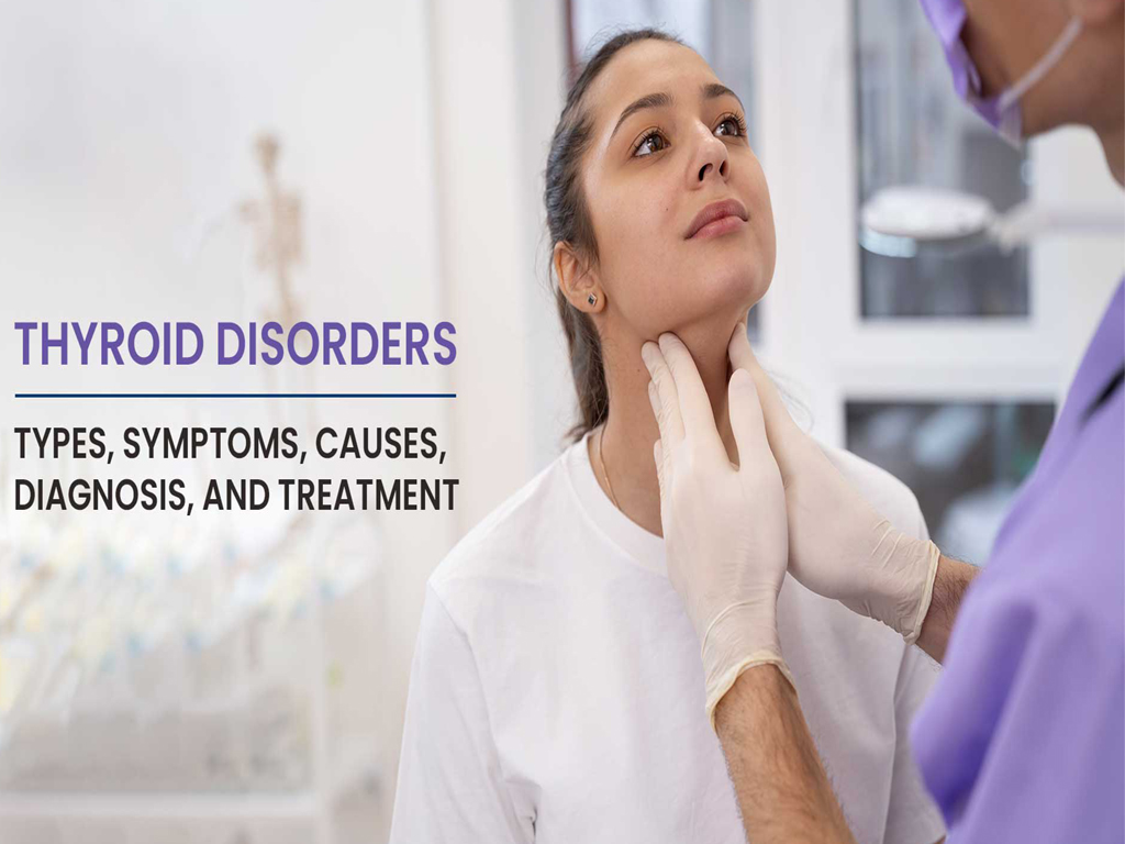 Thyroid Disorders